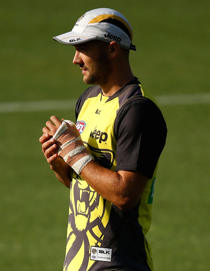 AFL 2016 Training - Richmond Training 150316 MELBOURNE, AUSTRALIA - MARCH 15: Shaun Grigg of the Tigers looks on during the Richmond Tigers training session at Punt Road Oval in Melbourne on March 15, 2016. (Photo by Michael Willson/AFL Media)